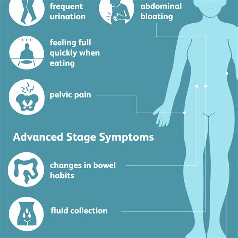 are ovarian cancer symptoms similar to uti symptoms
